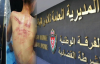 هذا ما قالته مديرية الامن حول صور تعذيب طفل بإمزورن من طرف الشرطة