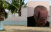 الناظور.. والد تلميذ يرسل مدير مدرسة ابتدائية الى المستشفى