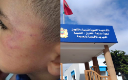 أستاذة تُعنف تلميذًا يتيما في امزورن وتثير موجة استياء